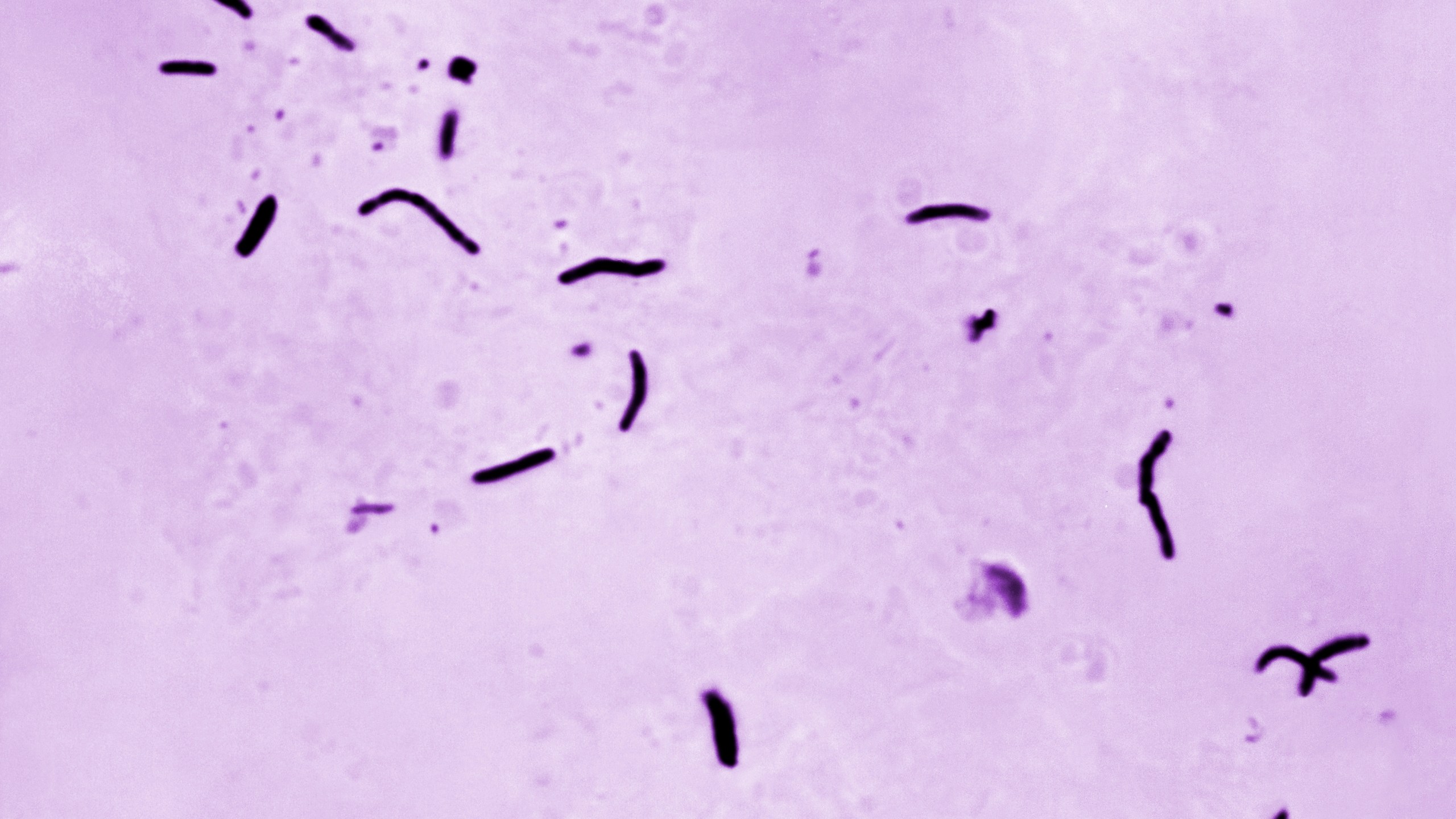 This 1966 microscope photo provided by the U.S. Centers for Disease Control and Prevention shows Mycobacterium tuberculosis bacilli, the organism responsible for causing the disease tuberculosis. The number of U.S. tuberculosis cases in 2023 were the highest in a decade, according to a report released by the CDC on Thursday, March 28, 2024. (Elizabeth S. Mingioli/CDC via AP)