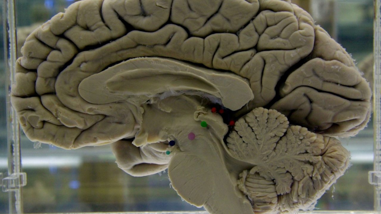 A section of a preserved human brain.