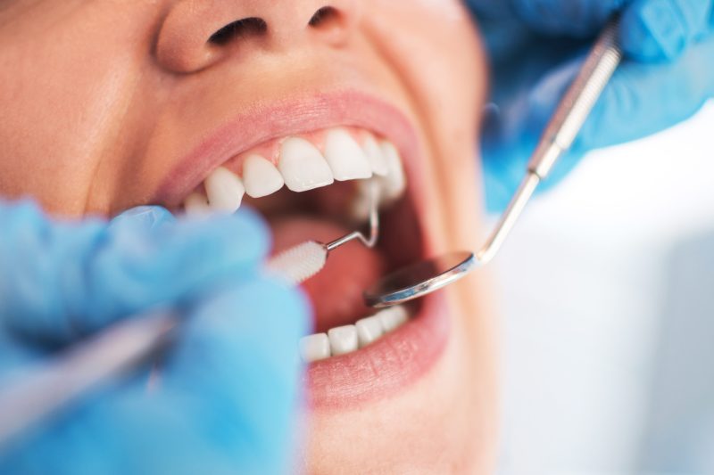 A woman opens her mouth as a dentist or dental hygienist cleans her teeth.
