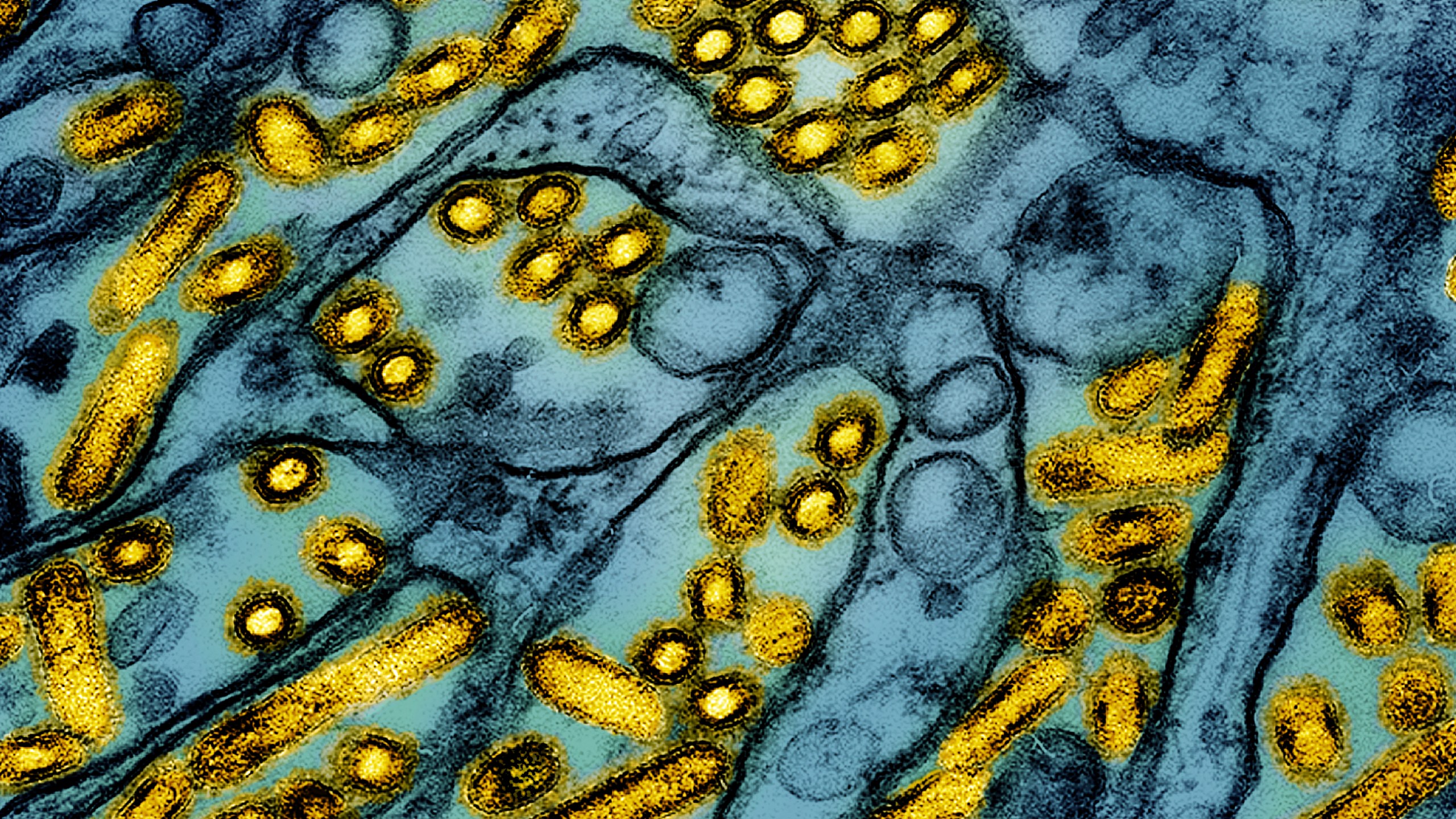 FILE - This colorized electron microscope image released by the National Institute of Allergy and Infectious Diseases on March 26, 2024, shows avian influenza A H5N1 virus particles (yellow), grown in Madin-Darby Canine Kidney (MDCK) epithelial cells (blue). (CDC/NIAID via AP, File)
