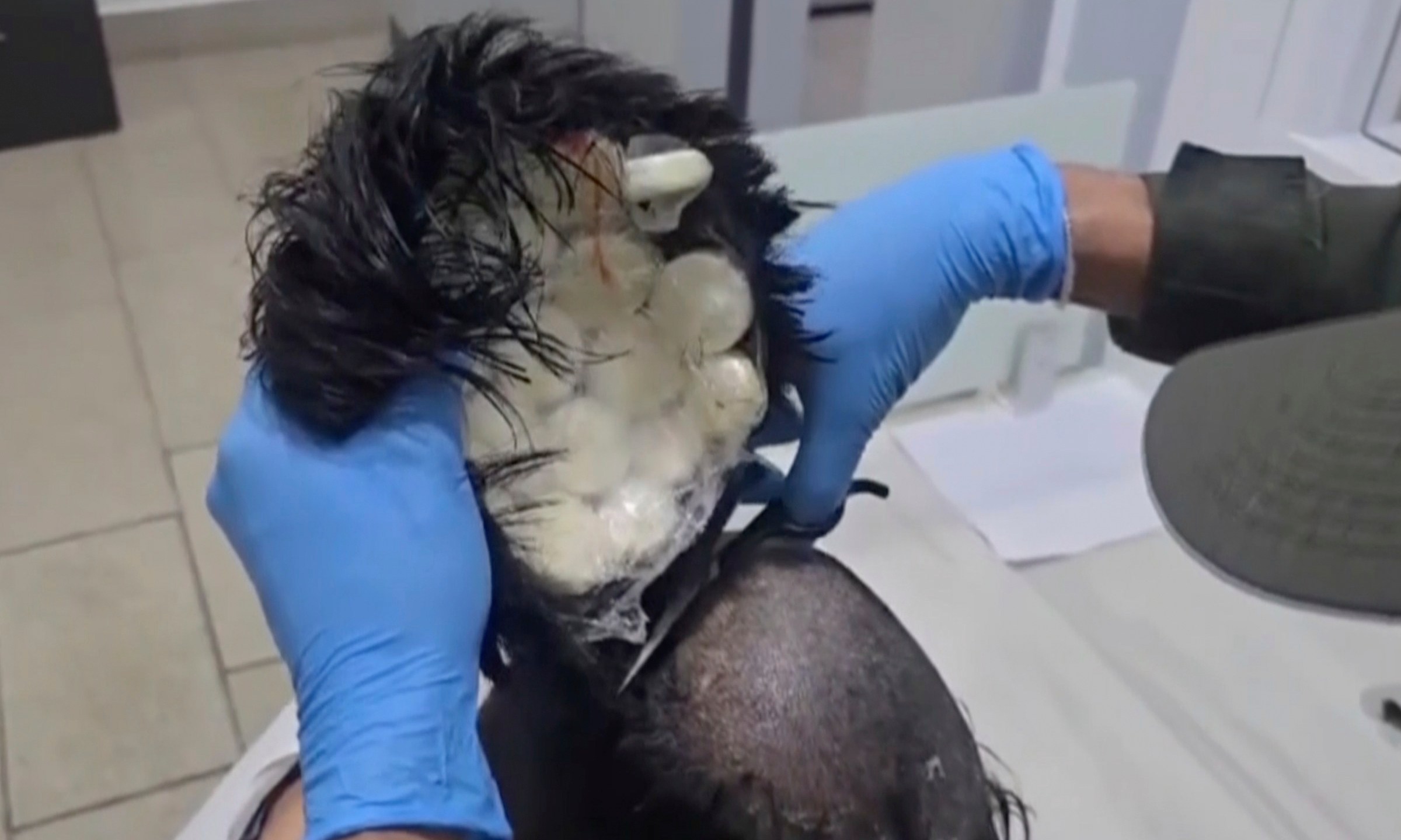 In this screenshot taken from a video provided by the Colombian National Police, Colombian police catch a man smuggling packets of cocaine under his toupee at the airport in Cartagena, Colombia, Monday, Feb. 24, 2025. (Via Colombian National Police)