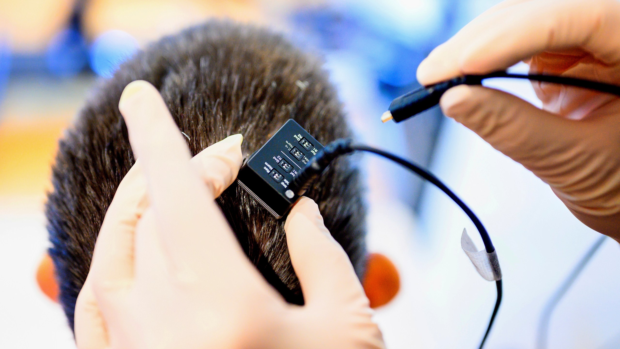 In this photo provided by researchers researchers at UCSF and UC Berkeley, a UCSF clinical research coordinator connects a neural data port into the head of Ann, a participant in a study on speech neuroprostheses, in El Cerrito, Calif., on Monday, May 22, 2023. (Noah Berger/UCSF, UC Berkeley via AP)