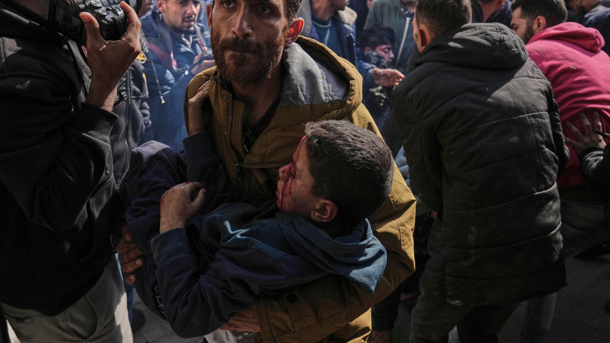 Palestinian children injured in an Israeli airstrike are brought to the Baptist Hospital in Gaza City, Saturday, April 12, 2025. (AP Photo/Jehad Alshrafi)