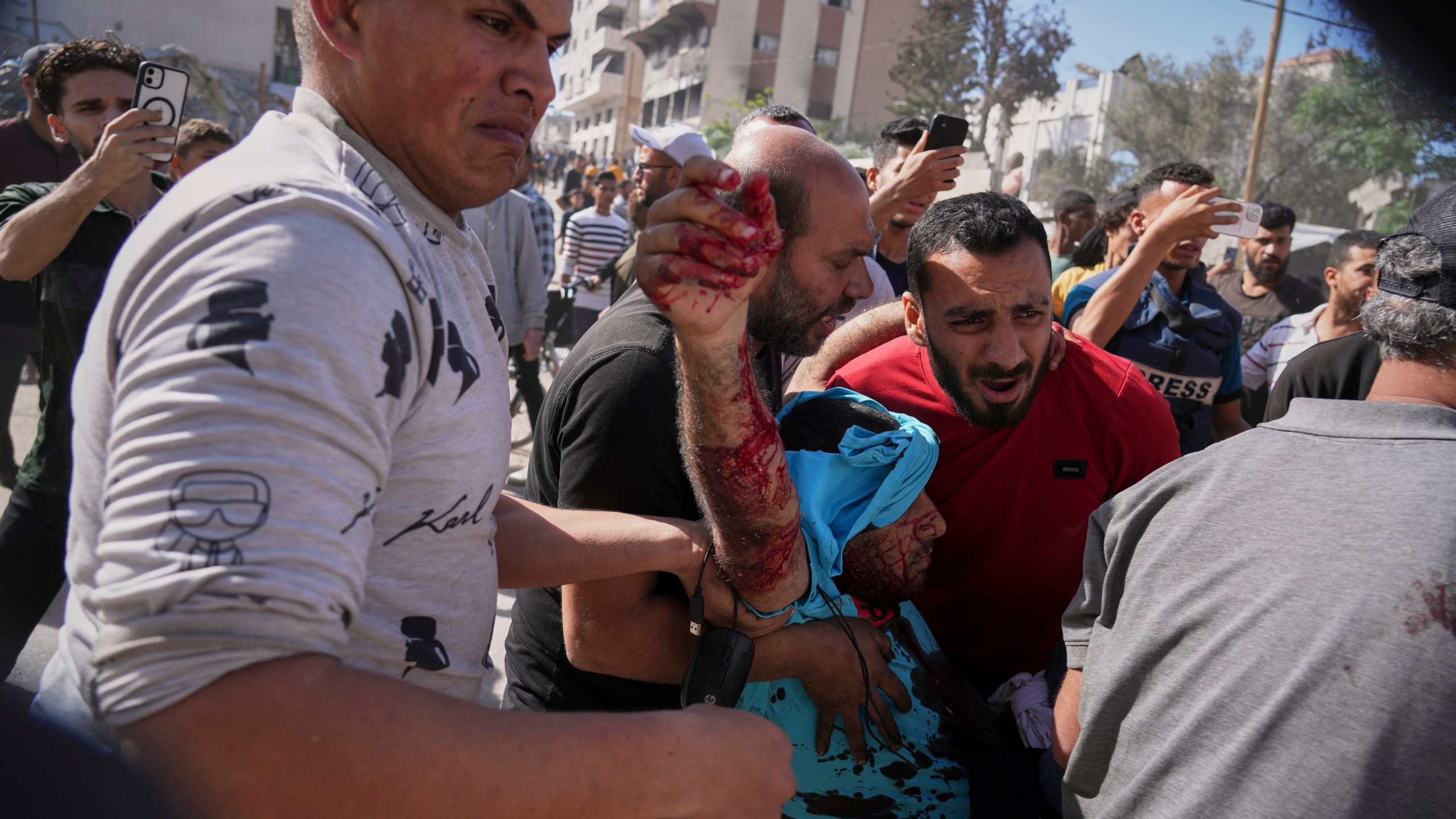 A man is carried away after being injured in an Israeli army drone strike on a sidewalk which killed at least two people, in downtown Gaza City, Friday, May 9, 2025. (AP Photo/Jehad Alshrafi)