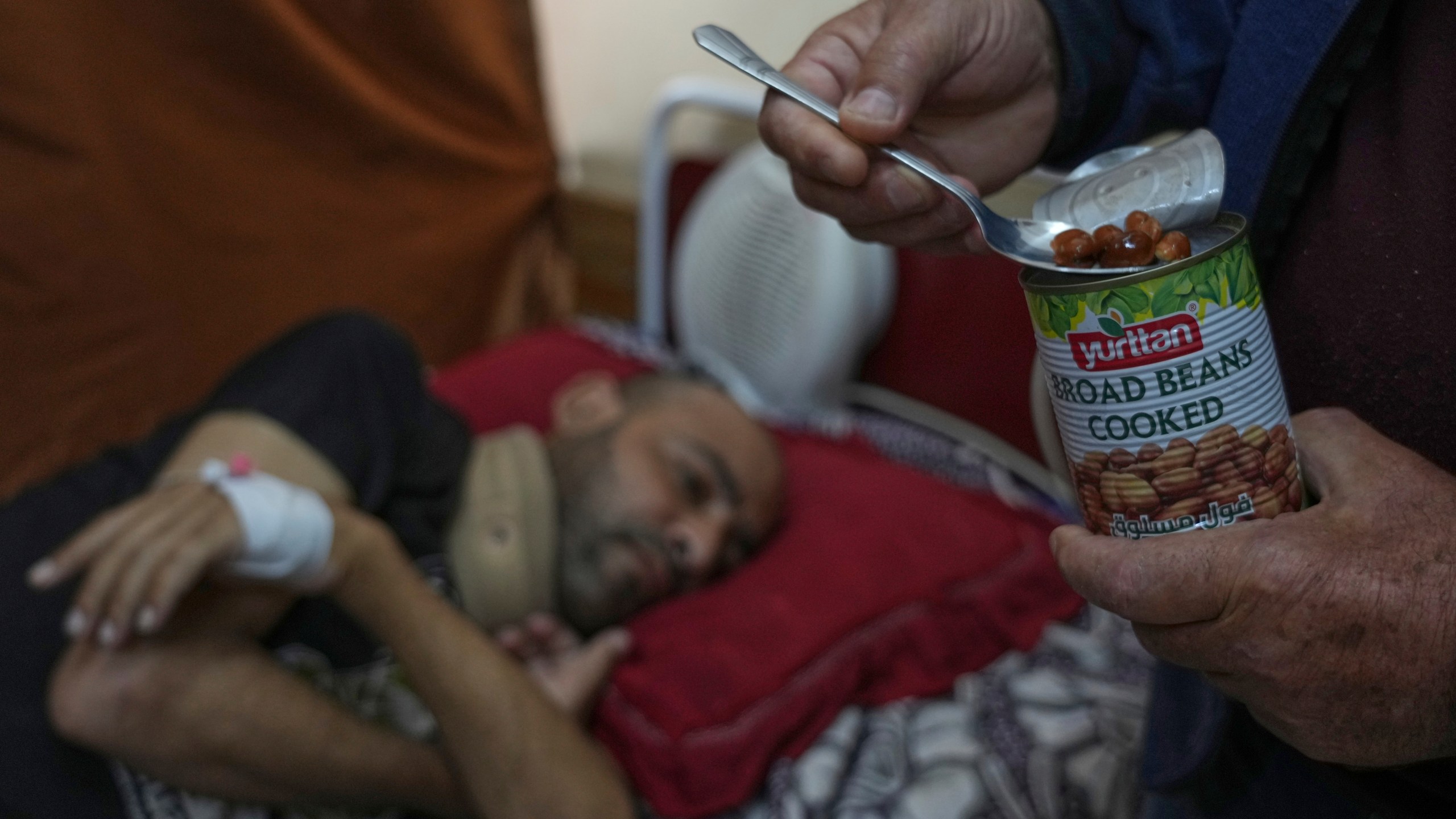 Sobhi al-Bursh, who was injured in a bombing and lost his foot, is fed beans brought from home by his father, Mohamed, at Nasser Hospital in Khan Younis, Gaza Strip, Tuesday, May 6, 2025. (AP Photo/Abdel Kareem Hana)