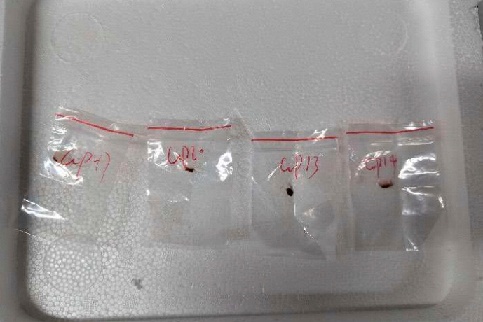 This image provided by United States District Court For The Eastern District Of Michigan shows toxic plant pathogens that a Chinese scientist entered the U.S. last year stashed in his backpack, federal authorities said Tuesday, June 3, 2025, as they filed charges against him and a girlfriend who worked in a lab at the University of Michigan. (United States District Court For The Eastern District Of Michigan via AP) A