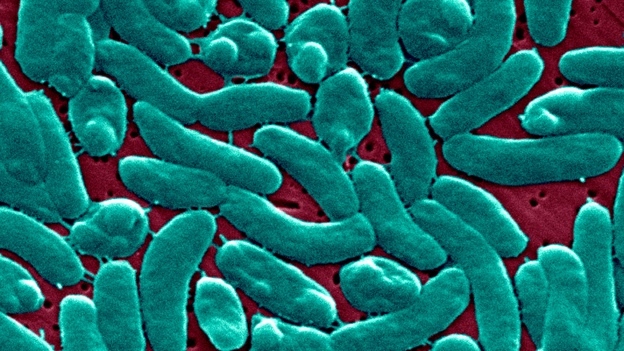 Vibrio vulnificus bacteria is pictured