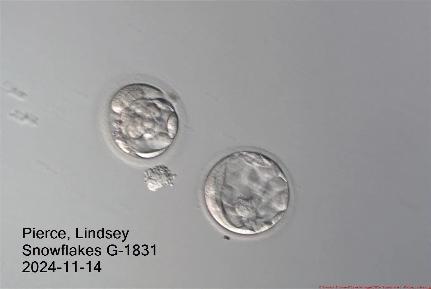 This image provided by Rejoice and John David Gordon, shows the two embryos on Nov. 14, 2024, that survived being frozen for thirty years. (Rejoice and John David Gordon via AP)