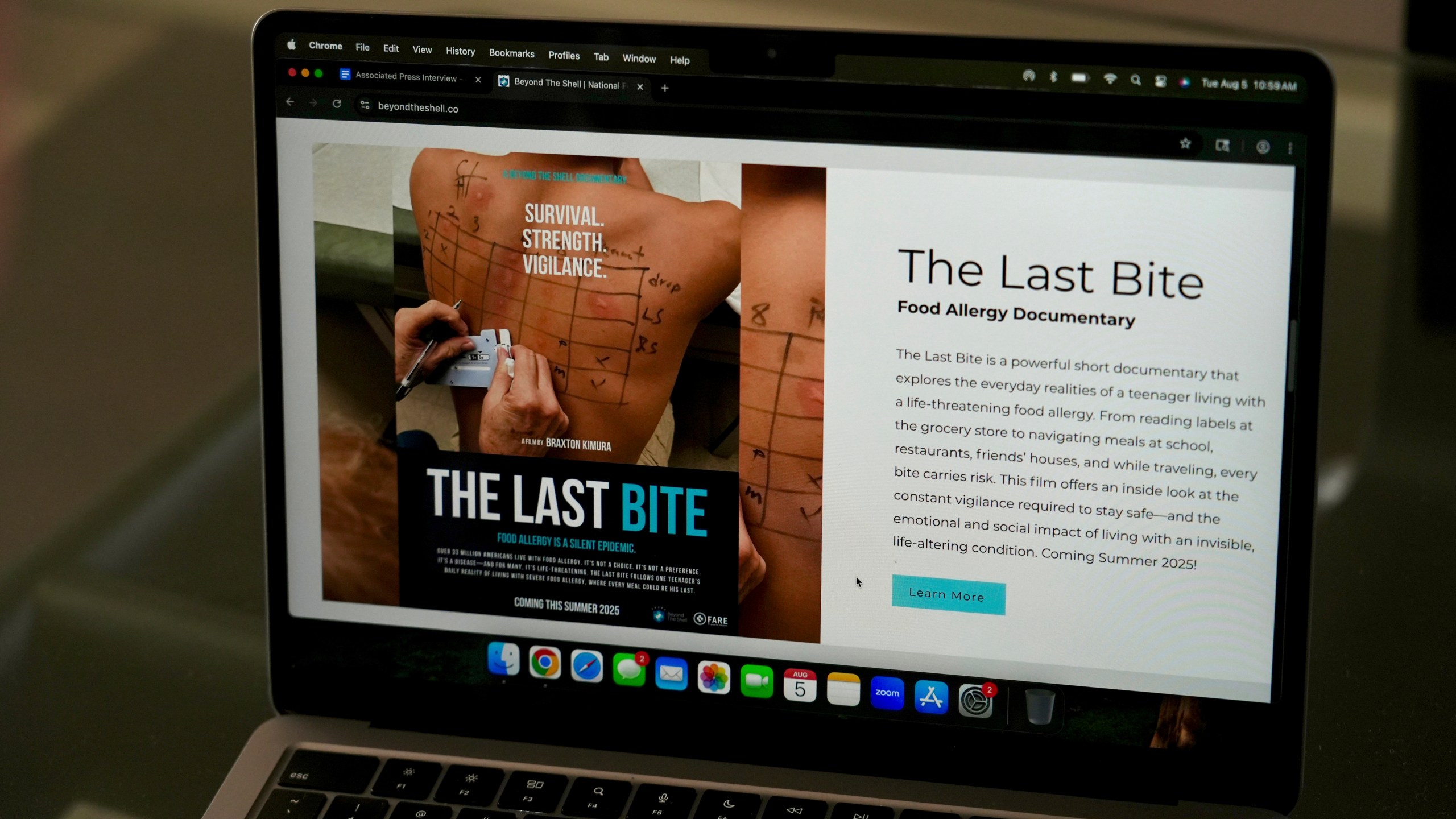 Braxton Kimura watches a food allergy documentary on Wednesday, Aug. 13, 2025, in San Jose, Calif. (AP Photo/Terry Chea)