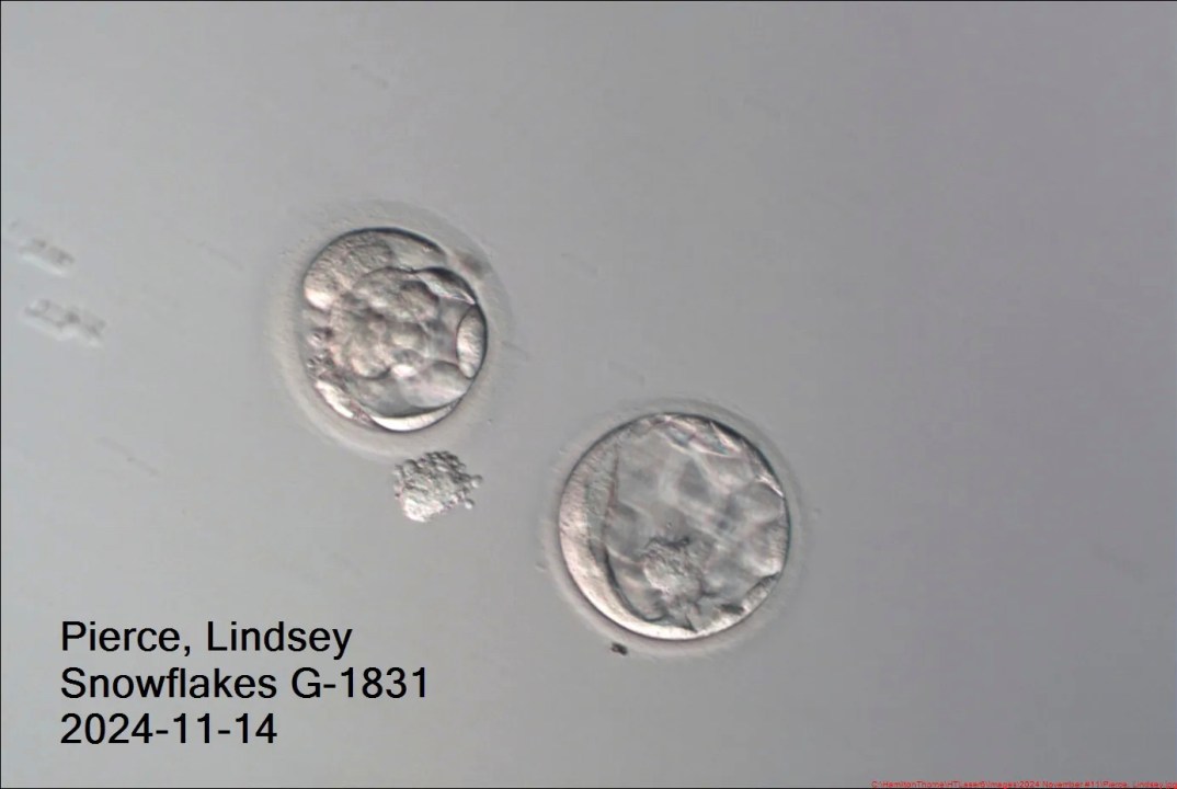 An image of two embryos that survived being frozen for thirty years. 