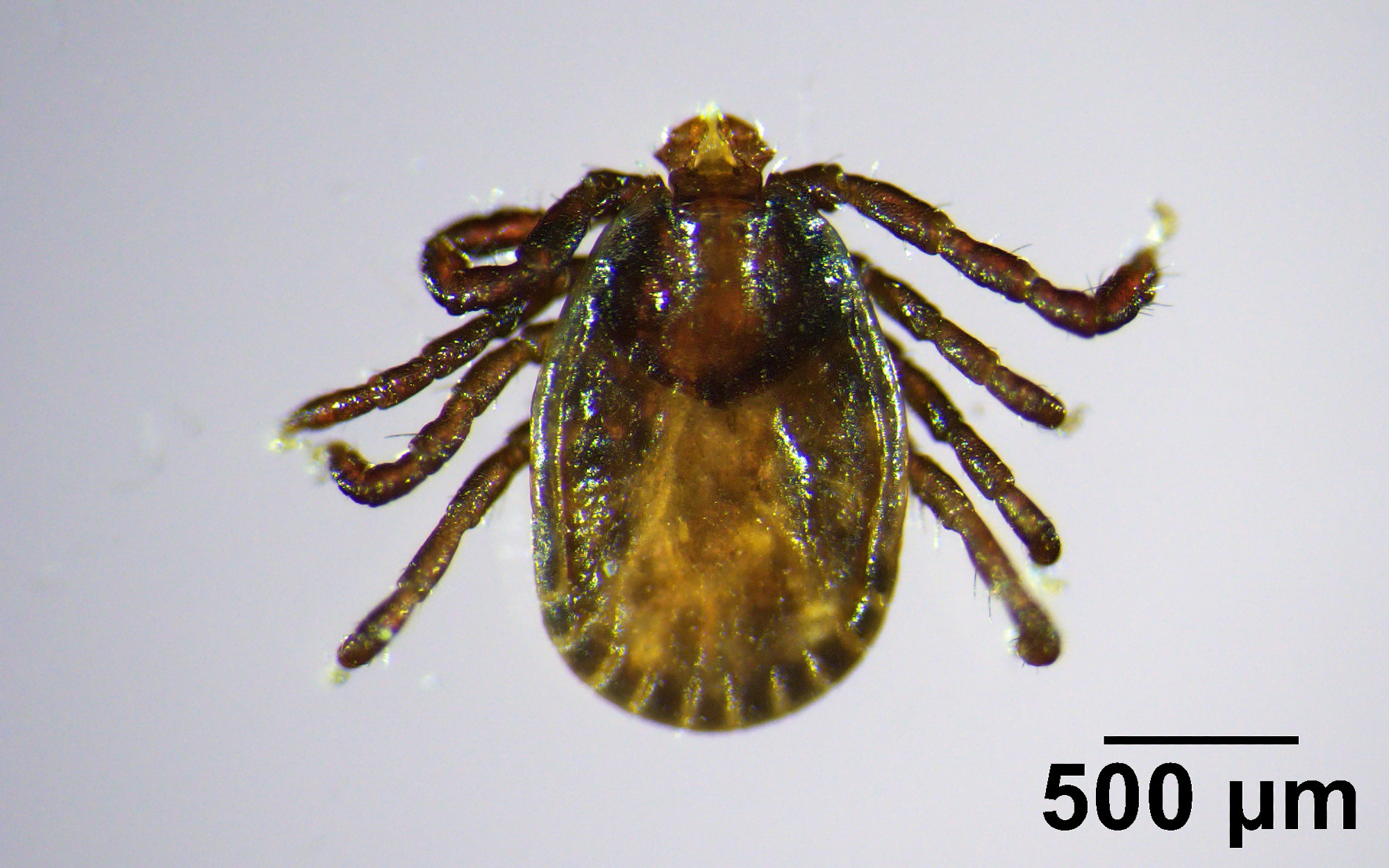 This handout photo provided by the University of Maine and taken in July, 2025 shows an Asian longhorned tick. (Griffin Dill/University of Maine via AP)