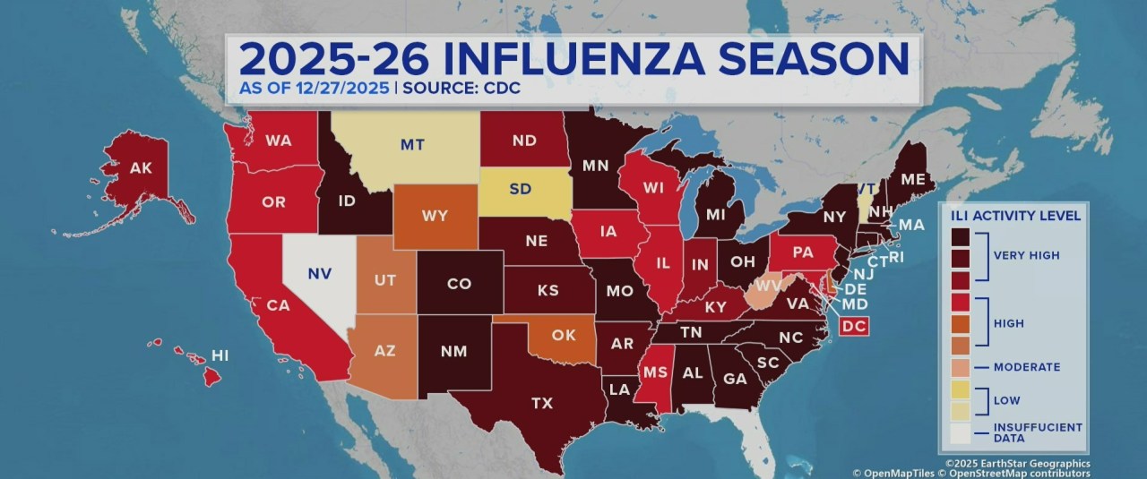 A map of influenza activity across the U.S.